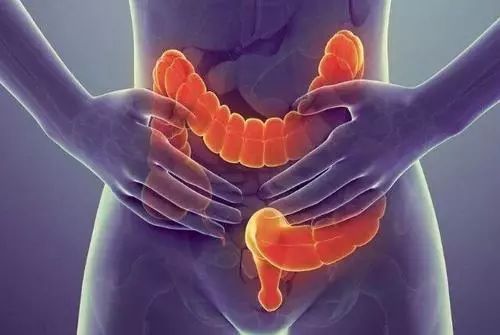 有直肠癌怎么办,结直肠癌早期的6个症状