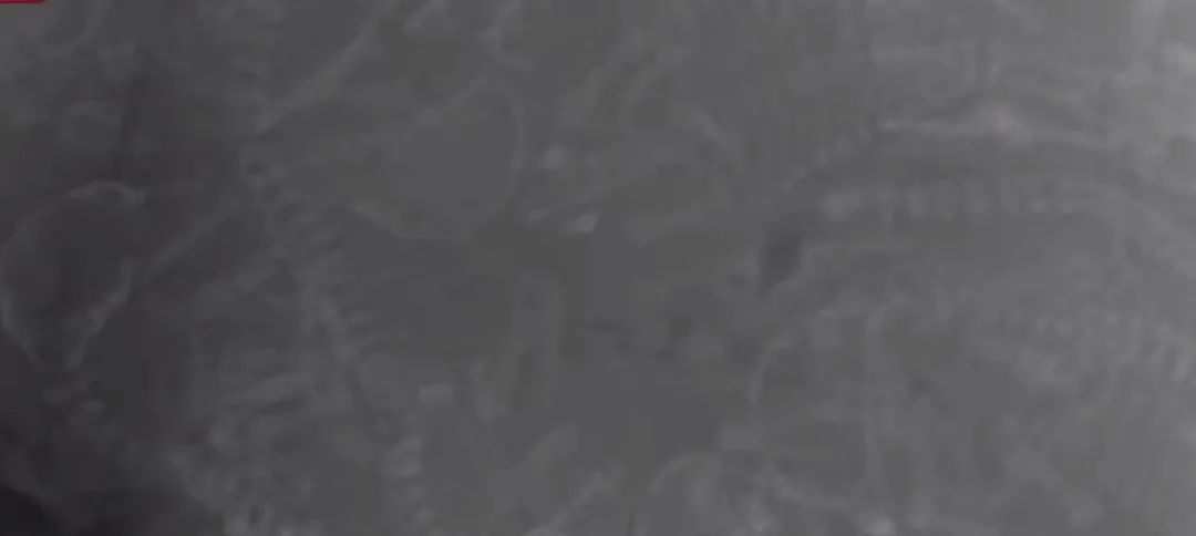 肚子里密密麻麻全是狗！狗妈妈19小时生20只狗崽，医生轮番上阵