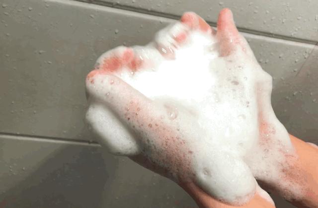 头发毛躁并且脱发推荐洗发水,用什么洗发水改善头皮脱发