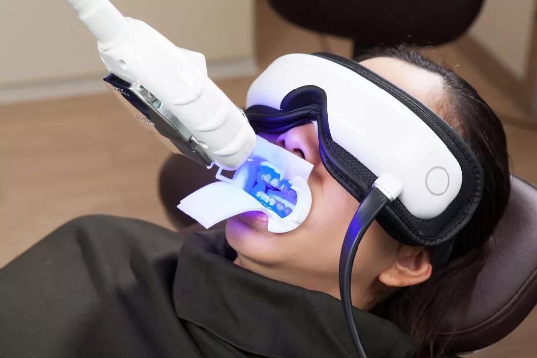 牙齿美白最好的技术,口腔牙齿美白