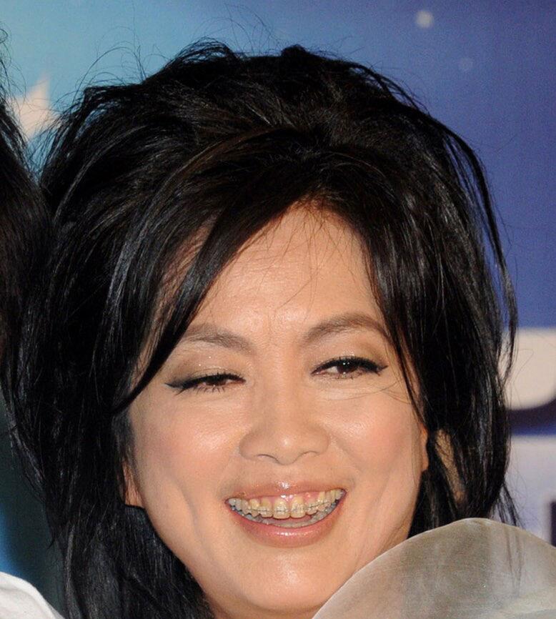 吴宣仪烤瓷牙怎么做,吴宣仪的整牙前