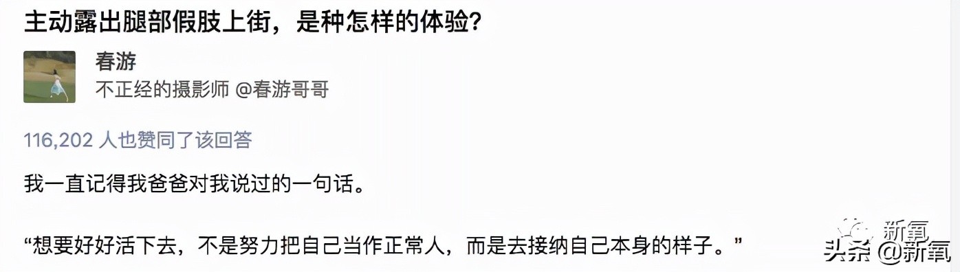 连​她也要被质疑靠腿炒作？