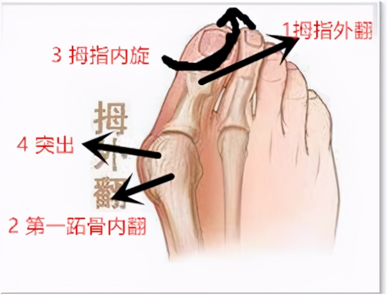 糖友口腔溃疡怎么办,糖尿病老人口腔溃疡