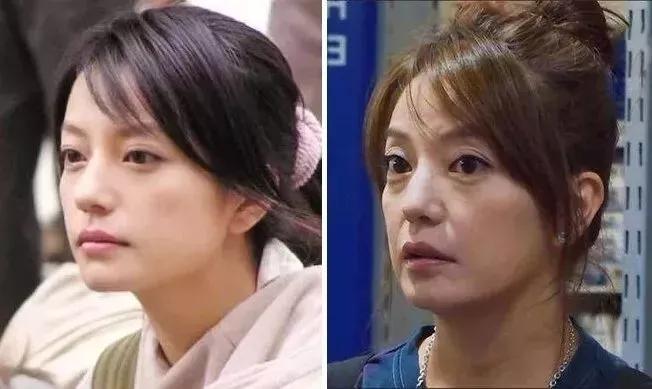 眼袋越来越严重怎么救,有眼袋显老十岁一招教你消除