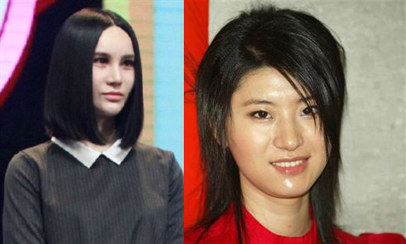 法令纹填充玻尿酸显老,玻尿酸填充法令纹显老怎么办