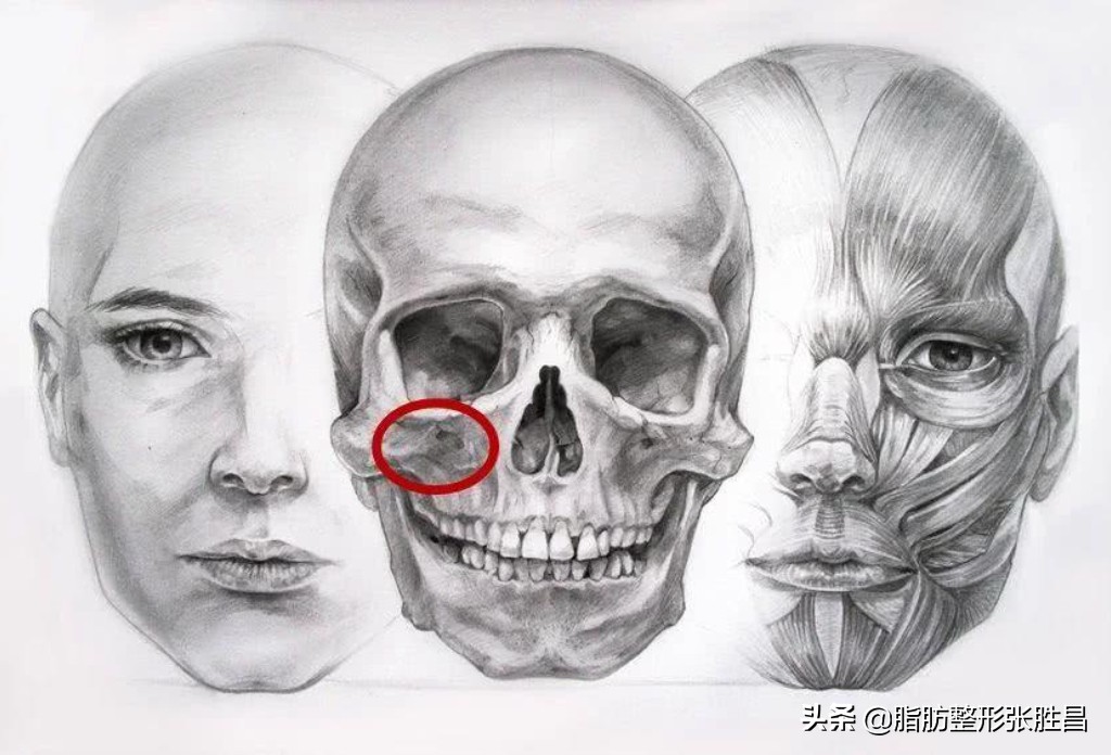 颧骨突出面相刻薄怎么办,脸型崎岖颧骨突出
