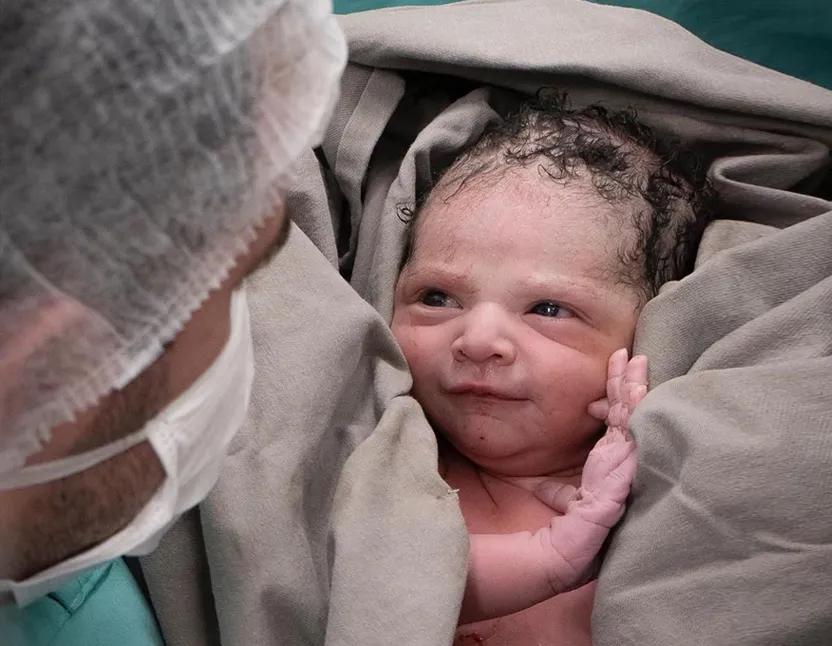 剖宫产过程亲身经历,剖宫产亲身经历