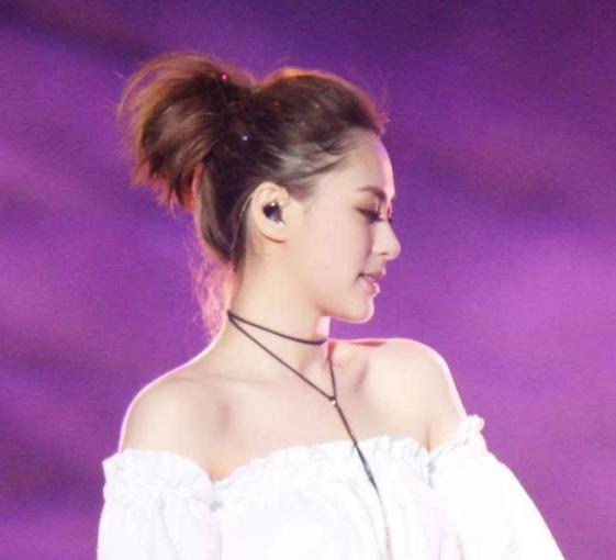 阿娇头部受伤缠绷带照曝光,阿娇受伤后拆绷带首露面