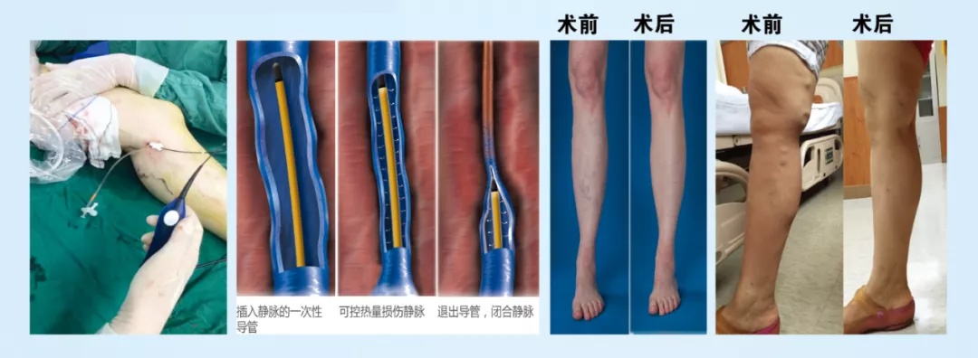 西安红会医院心血管住院部,西安市红会医院心血管内科地址
