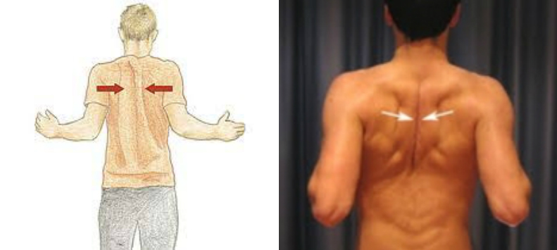 硬拉弓腰算成功吗,改善硬拉容易弓背的动作