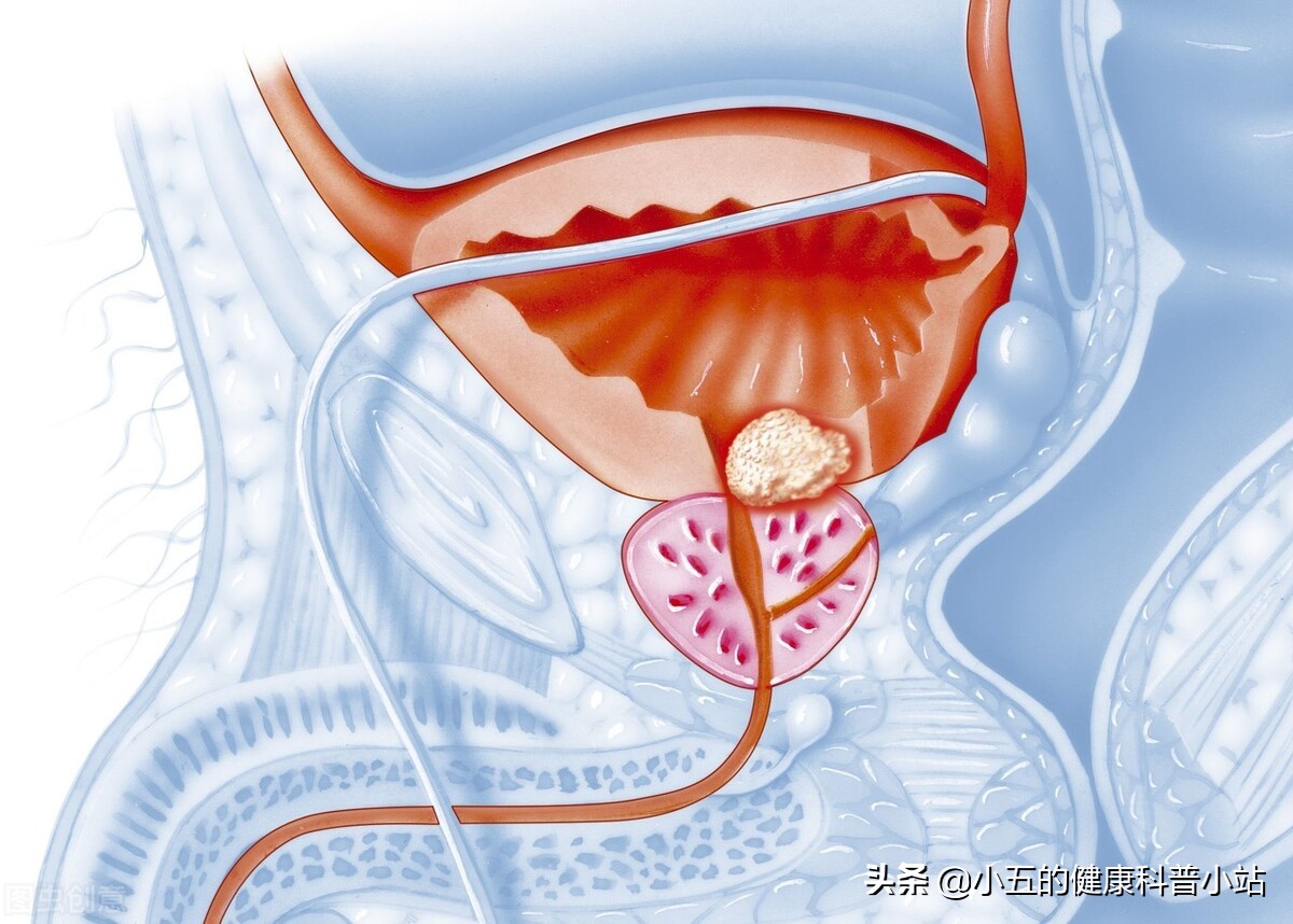 调理前列腺炎的话题,浅谈治疗前列腺炎的药物