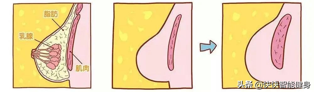 减肥后胸变小了下垂怎么回事,减肥之后胸也跟着小了怎么办