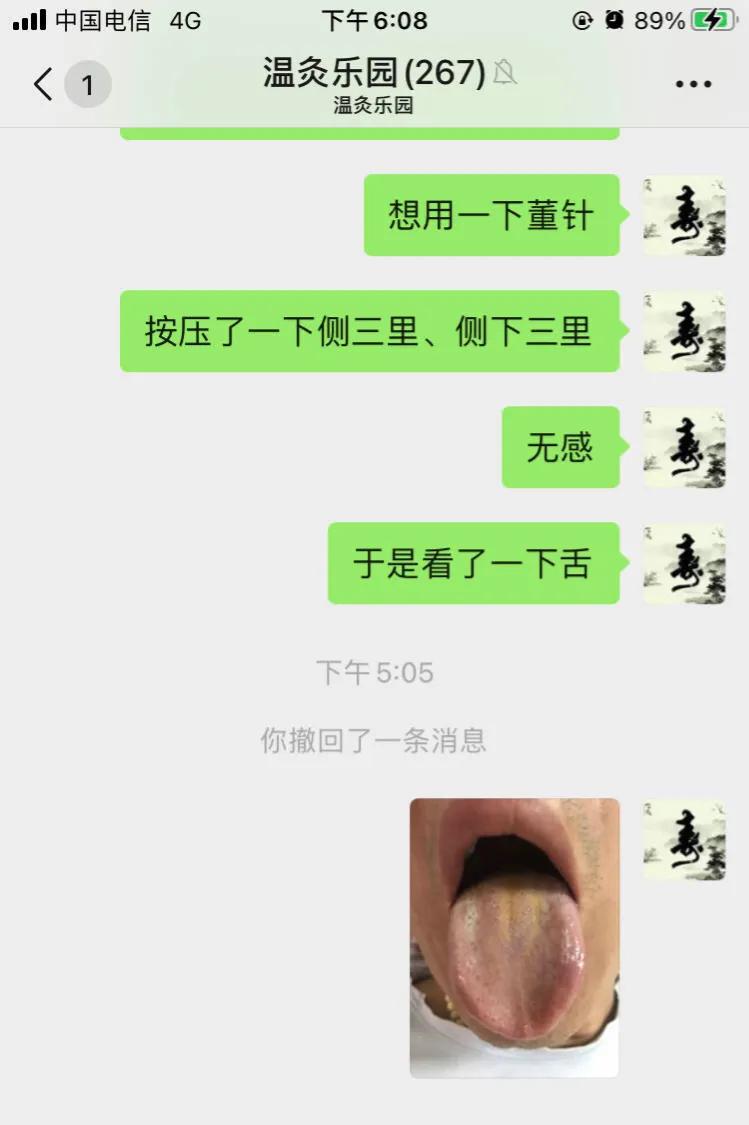 胸痛针灸哪些穴位可以治,董氏针灸治疗岔气胸痛