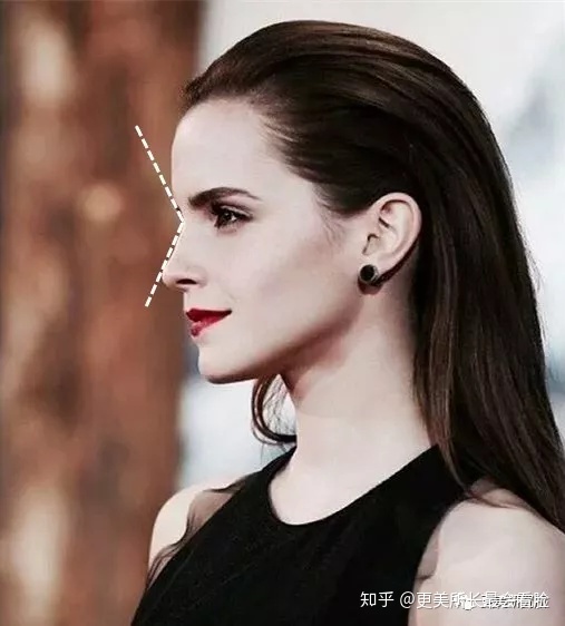 好看的侧脸要符合哪些条件,好看的侧脸的标准