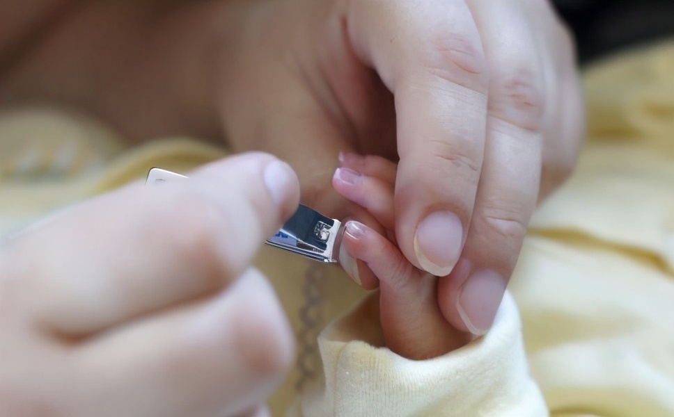 宝宝手上长倒刺家长千万别忽视,宝宝手上长倒刺妈妈要学会呵护