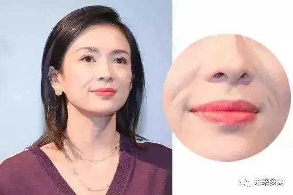 怎样淡化法令纹10个方法,法令纹显老10岁三种方法帮助改善