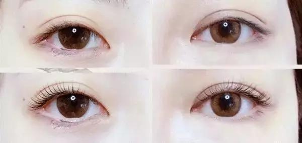 鑺辩摚缇庡鎶よ偆,鑺辩摚鎶よ偆