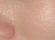 打败毛孔！下一个反孔精英就是你！