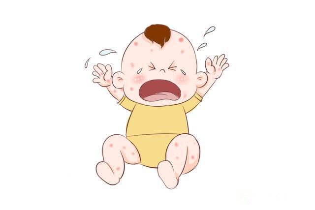 宝宝脸上长红点怎么分辨是过敏,宝宝脸上红点识别图