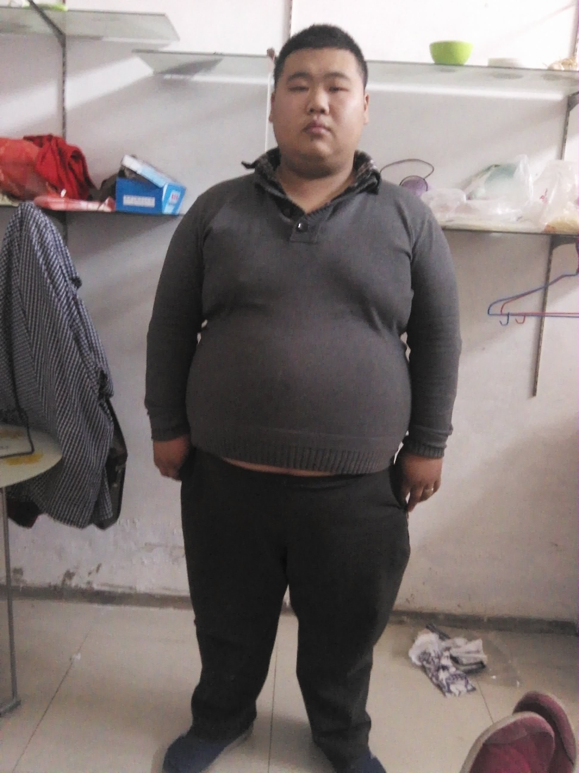 王存川减重第一人,王存川教授减重手术