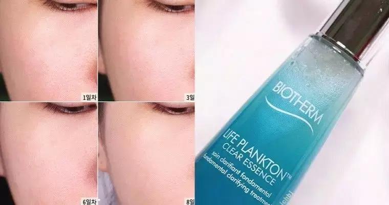 毛孔黑粗大收缩毛孔最有效的方法,毛孔粗大怎么办教你几招收缩毛孔