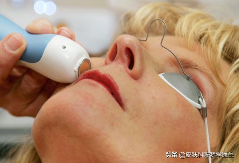 雀斑复发怎么治疗,雀斑怎么解决