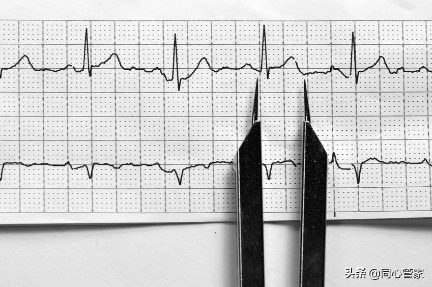 心脏心率过慢会怎么样,心脏长期心跳过快有啥坏处