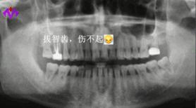 种2颗牙没了3万，中国人为什么没有“看牙自由”？