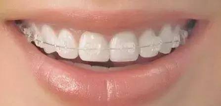 nasa技术有多强,spacex的技术来自nasa吗