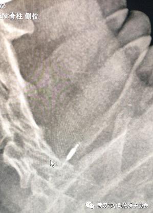 拳头大小的肿瘤可能是良性的吗,肿瘤长得越来越大就是癌症晚期吗