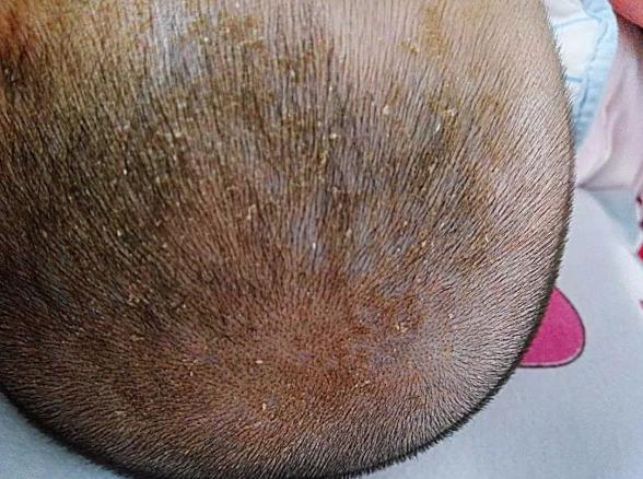 宝宝身上这四个部位不宜过度清洗,宝宝身上这四个部位越脏越好