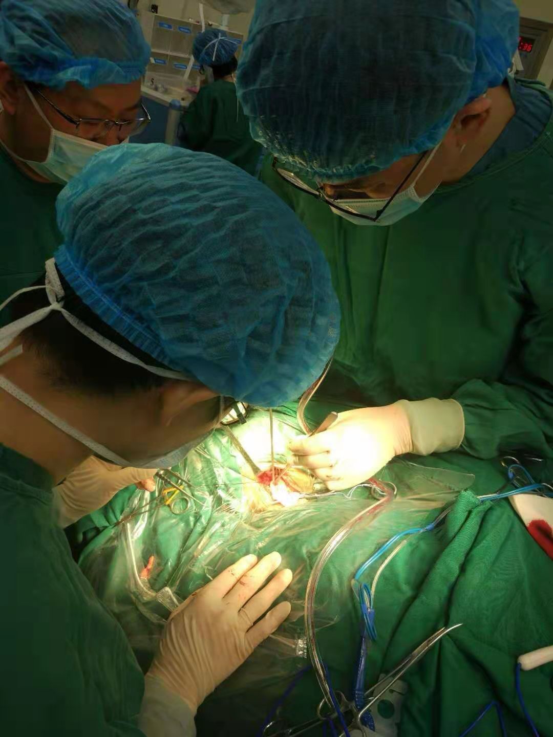 衡水人民医院神经外科医生排名,衡水市人民医院神经外科