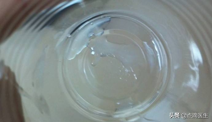 精子全项检查项目,精子全套详细检查