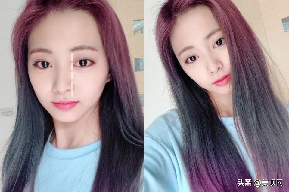 韩国整容模板jennie,韩国整形面容