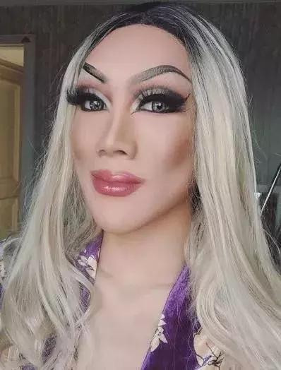 先天性唇裂男孩被抛弃,先天唇裂从小被母亲抛弃