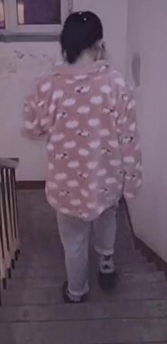 AI助力精准处理IV型髋关节发育不良花季少女翻开人生新篇章