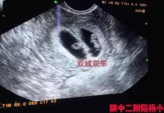 陕西中医药大学附属医院生殖科,中医药大学附属第二医院生殖中心