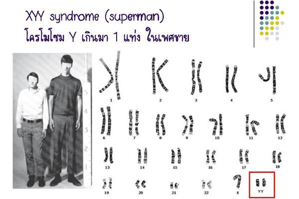 犯罪面相有哪些特征,面相和犯罪率的关系