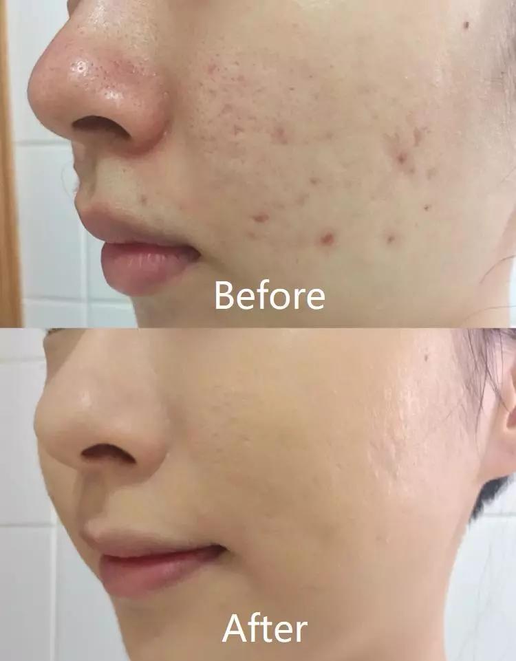 毛戈平的气垫好还是粉霜好,十大公认好用的气垫毛戈平