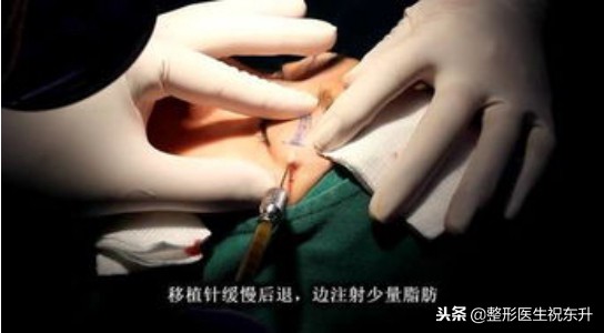 20岁眼睛凹陷是什么原因呢,眼眶会随着年龄变大凹陷