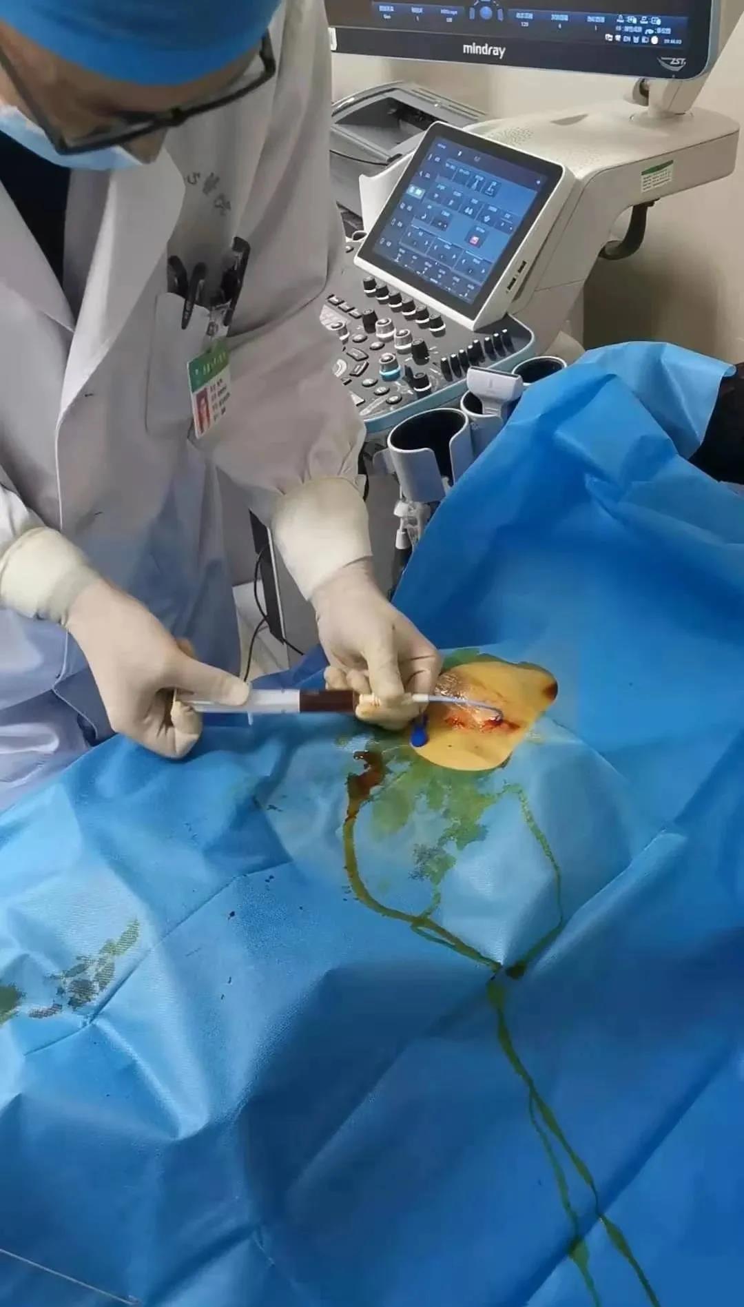 *安泰**市中心医院肝胆外科副主任医师刘阳:“肝胆相照”彰显医者仁心方寸之间演绎“镜下乾坤”