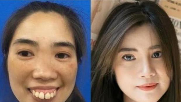 整容不一定能改变命运,整容整形真实经历