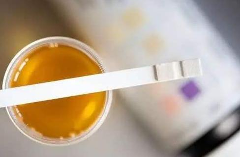 尿蛋白可疑阳性注意事项,大便隐血假阳性有哪些因素