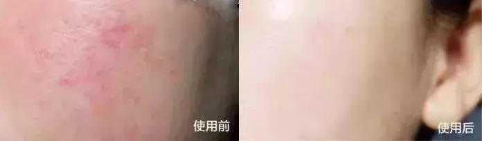 沈梦辰美白精华,沈梦辰推荐的美白精华液