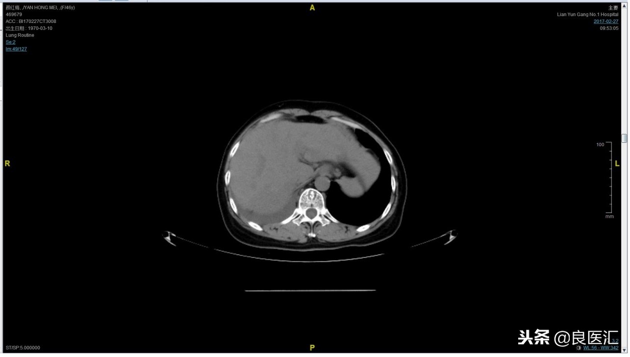 美图秀秀成功案例,美图秀秀实战案例
