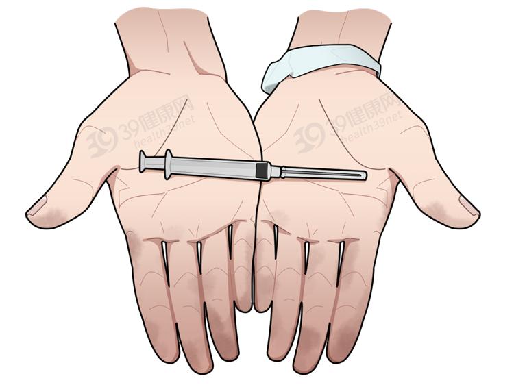 判断吸毒最简单的办法,吸毒早期的5个特征