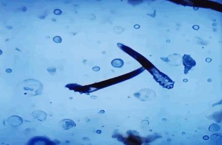 除螨大作战螨虫,除螨大作战让你告别螨虫