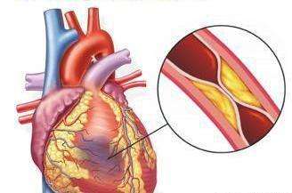 得了冠心病用经常吃药吗,得了冠心病以后出现心绞痛怎么办