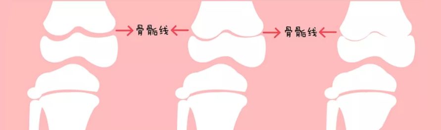 女孩身高逆袭,一年长高10cm方法20岁