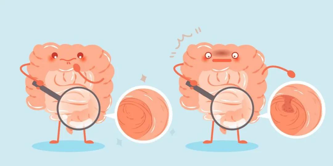 便血就是得了直肠癌吗,痔疮便血与肠子出血的区别